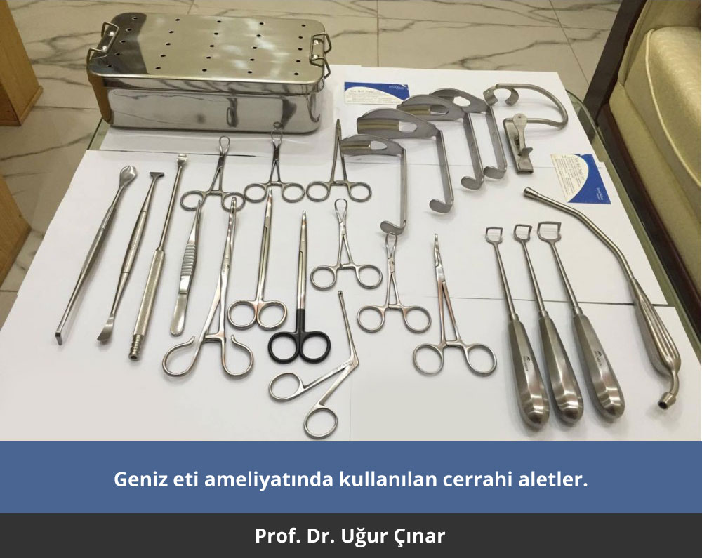 Geniz eti ameliyat aletleri - Prof. Dr. Uğur Çınar