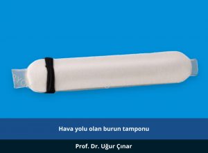 Hava yolu olan burun tamponu - Prof. Dr. Uğur Çınar