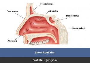 Konka Büyümesi - Prof. Dr. Uğur Çınar